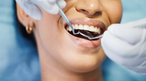 Best Emergency Denture Repair in Ransomville, NY